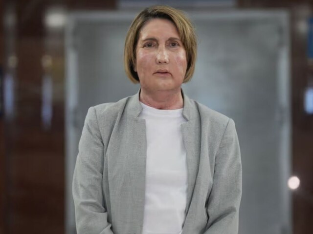 मांस खाने वाले कीड़ों ने चबा लिया महिला का चेहरा, फिर मिला नया चेहरा!