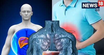 Fatty Liver: 5 Abdominal Symptoms You Must Not Ignore; Seek Doctor Immediately