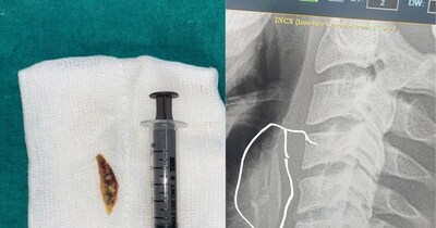 शाजापुर से हैरान कर देने वाली खबर आई है. 