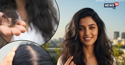  जब आप इन बदलावों को अपनी आदत बना लेते हैं, तो कुछ ही हफ्तों में स्कैल्प हेल्दी होने लगता है.