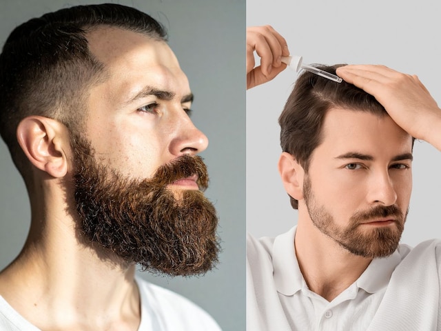 টাক জায়গায় আবার চুল গজাতে পারে? এই চীনা ভেষজ বিস্ময়কর কাজ করবে!