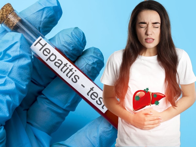 হেপাটাইটিস বি এবং সি রোগ কতটা বিপজ্জনক? চিকিত্সকের কাছ থেকে চিকিত্সা এবং প্রতিরোধ জানুন