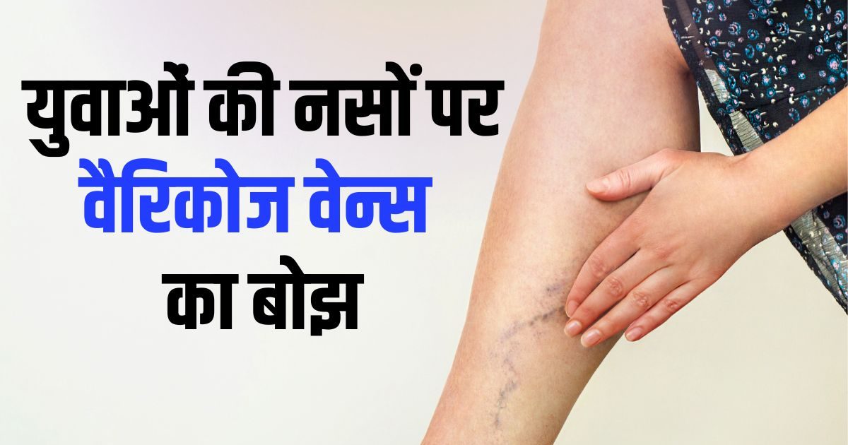 जवानी में ही ‘नसों’ का जाम! क्या आपकी डेस्क जॉब बना रही है आपको वैरिकोज वेन्स का शिकार?