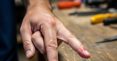 हाथ में चिपक गया है फेविक्विक? दर्द और त्वचा निकलने के डर के बिना हटाने के आसान उपाय.