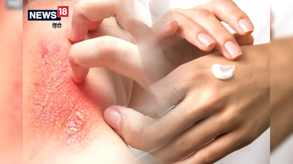 पानी में देर तक रहने से होती है स्किन प्रोब्लम, इस खास तेल को लगाएं, छूमंतर होगी दिक्कत!