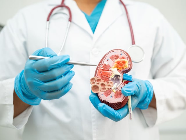 Which surgery is considered best to remove kidney stones? you also know