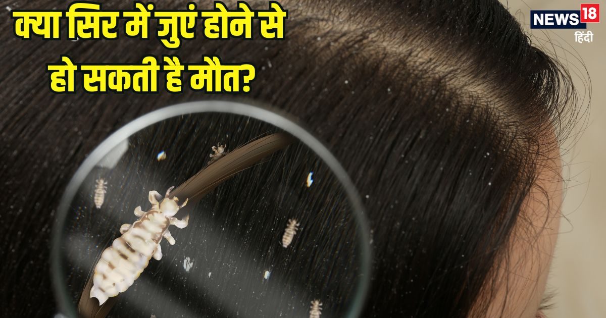 12 साल की लड़की के सिर में जुएं के कारण मौत! क्या ऐसा हो सकता है? डॉक्टर से जानें बचाव के उपाय