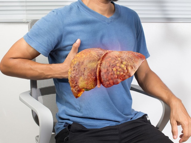 কর্মব্যস্ত অফিস লাইফে কিভাবে লিভার সুস্থ রাখা যায়