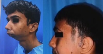 गोरखपुर एम्स के डॉक्टर ने सफल ऑपरेशन किया. 