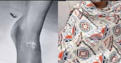 शराबी पिता ने 8 साल की बेटी को दी यातनाएं, शरीर पर मिले जलाने के निशान, गिरफ्तार.