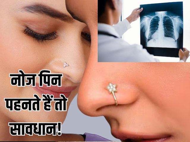 স্ত্রীরোগ বিশেষজ্ঞ রোগীর এক্স-রে রিপোর্ট শেয়ার করেন, নাকের পিন নিয়ে বিতর্ক শুরু হয়