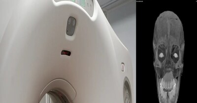 मौत के कारणों से लेकर लाश की एक-एक डिटेल बता गई रिपोर्ट (इमेज- फाइल फोटो) 