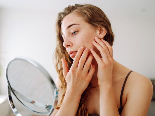 বায়ু দূষণের কারণে ত্বকের কী সমস্যা হতে পারে? চর্মরোগ বিশেষজ্ঞ থেকে বুঝতে