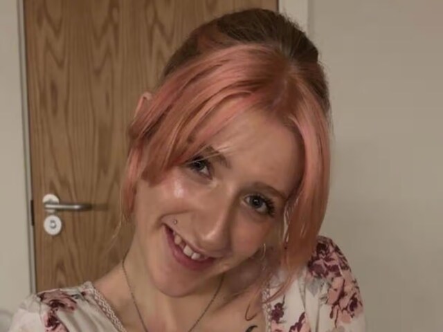 Teeth started breaking at the age of 20, this condition happened even after brushing every day!