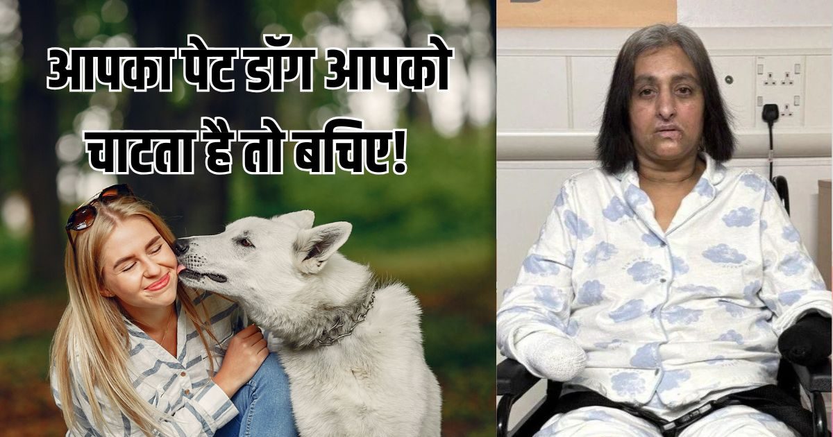 पेट डॉग अगर आपको चाटता है तो बचिए! कुत्ते की लार से महिला को 6 बार आया हार्ट अटैक, बचाने के लिए काटने पड़े हाथ-पैर