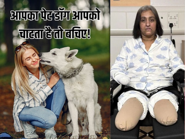 কুকুর চাটার কারণে 6 বার হার্ট অ্যাটাক হয়েছে, বাঁচাতে হাত-পা কেটে ফেলতে হয়েছে।