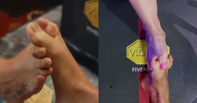 जानें क्या है इस रेस्लिंग की खासियत? (फोटो: Instagram/toewrestling)