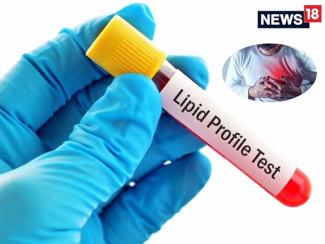 Lipid profile is not normal in 80 percent of Indians, what is this test and heart...