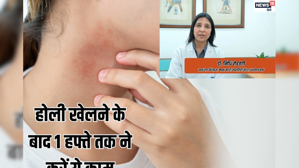 Doctor Opinion: होली खेलने के बाद 1 हफ्ते तक न जाएं पार्लर, जानें स्किन डैमेज से बचने का तरीका