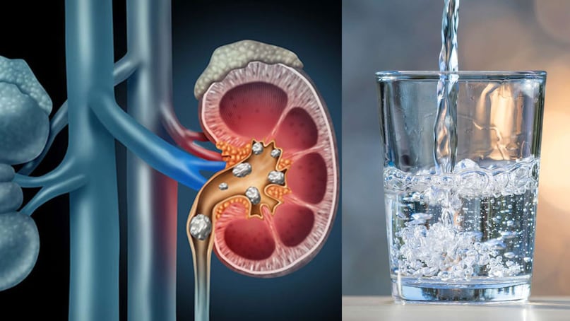 Kidney Cancer, Kidney, Cancer, health, కిడ్నీ, క్యాన్సర్, కిడ్నీ క్యాన్సర్, కిడ్నీ ఫెయిల్, ఆరోగ్యం Kidney Cancer, Kidney, Cancer, health, కిడ్నీ, క్యాన్సర్, కిడ్నీ క్యాన్సర్, కిడ్నీ ఫెయిల్, ఆరోగ్యం