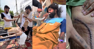 अनुराग डोभाल ने दिखाए चोट के निशान, लंबे टांके; पूछा- 'नई जिंदगी की शुरुआत देखोगे?'