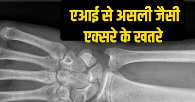 यह हाथ में स्केफॉयड बोन में हेयरलाइन फ्रेक्चर का एक्सरे AI से बनाई गई है. 