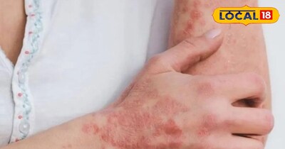 घरेलू तरीके से कर सकते हैं ठीक