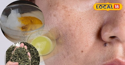 चेहरे पर दाग धब्बे हटाने के घरेलू उपाय