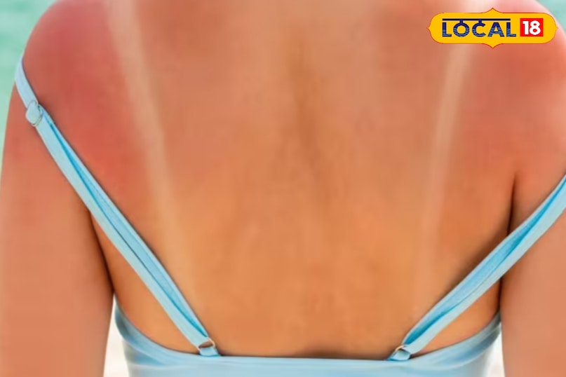 सनस्क्रीन