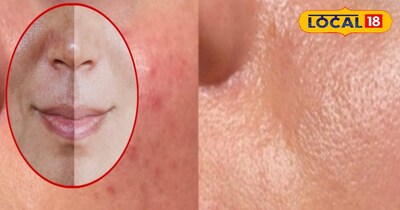 त्वचा के सुंदरता का राज 