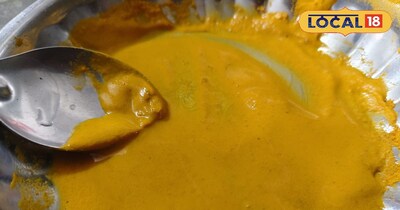 हल्दी का लेप 