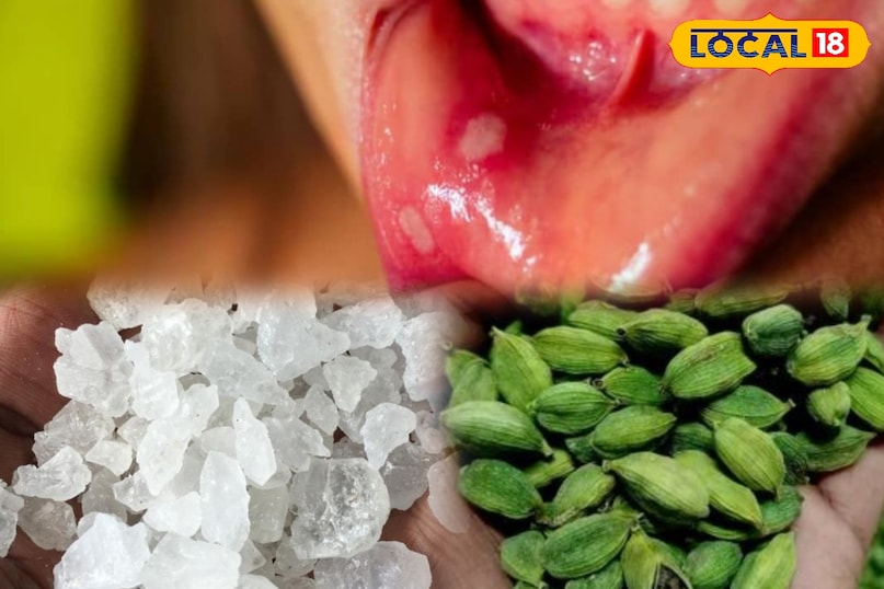 রান্নাঘরে লুকানো নিরাময়: চিনি ও এলাচ আলসারের জ্বালাপোড়া কমিয়ে দেবে...