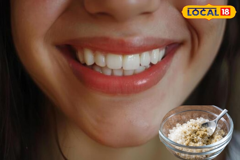 রান্নাঘরে লুকানো নিরাময়: চিনি ও এলাচ আলসারের জ্বালাপোড়া কমিয়ে দেবে...