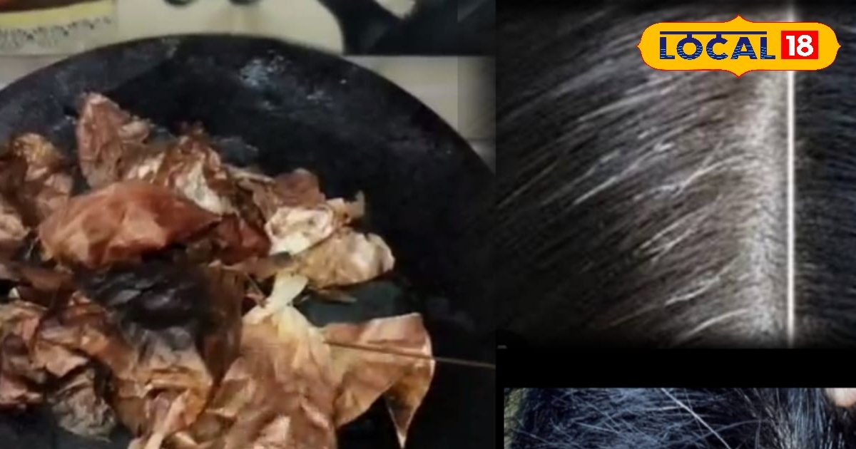 Hair Care Tips: सफेद बालों से परेशान? घर पर प्याज के छिलकों से तैयार करें नेचुरल डाई