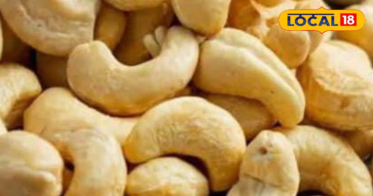 काजू से एलर्जी और पेट की समस्या? इन्हें खाने से पहले ध्यान रखें ये बातें