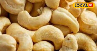 काजू सेहत के लिए हो सकते हैं नुकसानदायक ।