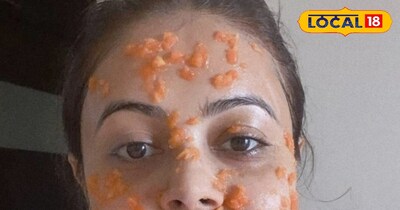 तेज धूप में जलन और टैनिंग से परेशान हैं? चेहरे को तुरंत ठंडक देने के ये आसान घरे