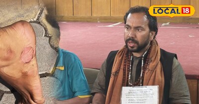 पहाड़ की बादल स्वास्थ्य व्यवस्था में सुधार के लिए गणेश भट्ट ने की पदयात्रा 