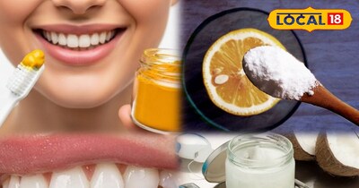 पीले दांत जट से करें साफ