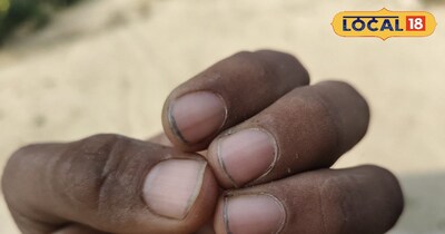 गंदे नाखून 