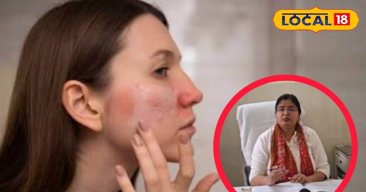 त्वचा के लिए मुलेठी ज्यादा अच्छी या एलोवेरा जेल? आप भी नहीं जानते होंगे ये वाली ट्रिक