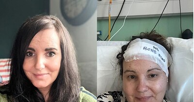 ब्रिटेन के केरफिली की रहने वाली जोडी बोल्टन की पहले और बाद की तस्वीरें.