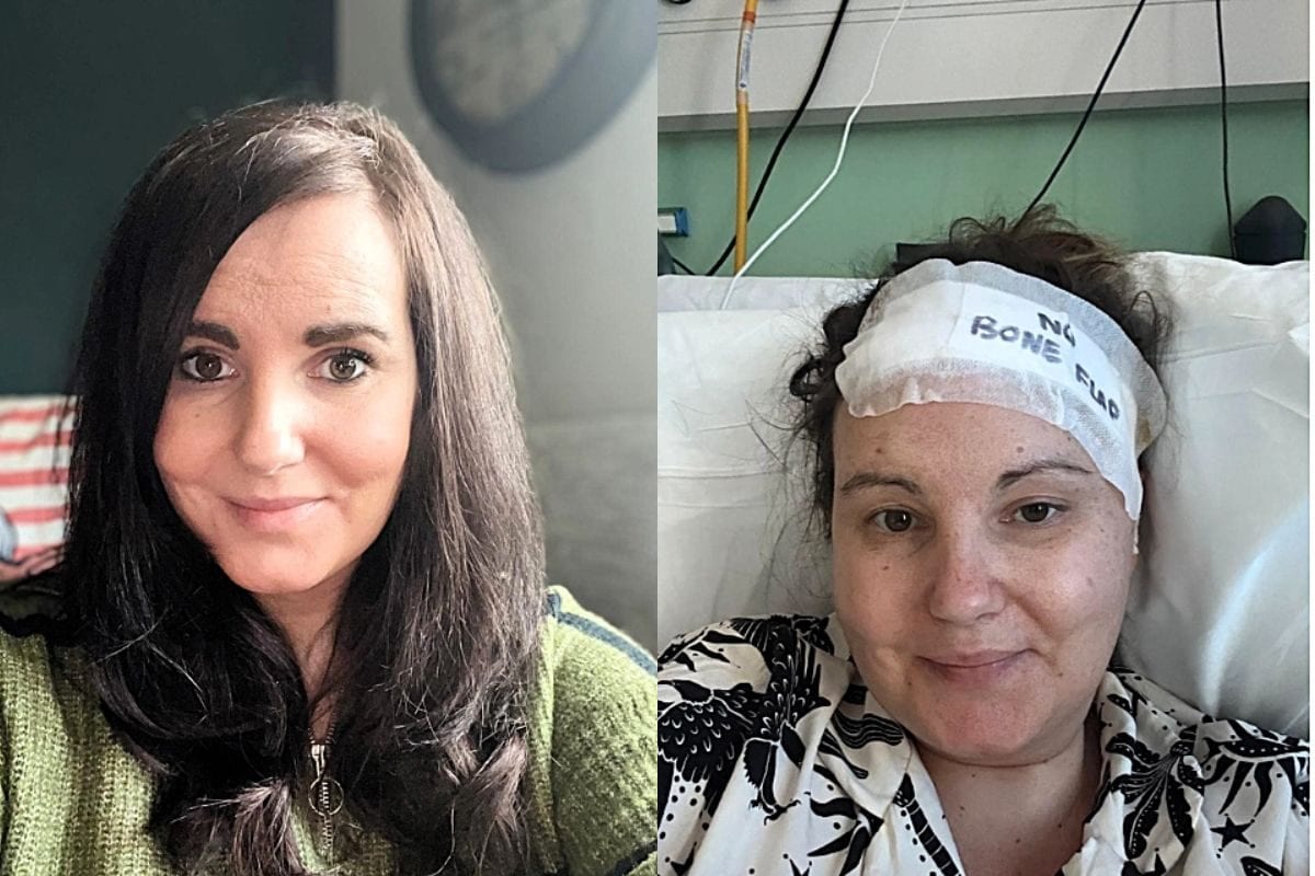 अचानक पीरियड्स हुए बंद, डॉक्टर्स बोले- तनाव का असर, फिर सिर से निकली ऐसी चीज, 'हेलमेट' में रहती है महिला!