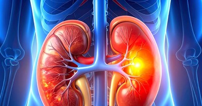 पेशाब में खून आना किडनी कैंसर का लक्षण हो सकता है.
