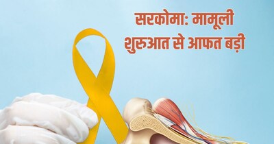 सरकोमा में कई प्रकार के कैंसर आते हैं. 
