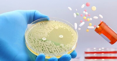 लिवर दवाओं को फिल्टर करता है, जिसकी वजह से ड्रग इंड्यूस्ड इंजरी का रिस्क बढ़ जाता है.