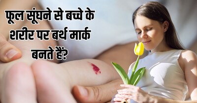 Birthmarks: Debunking Myths and Understanding Causes