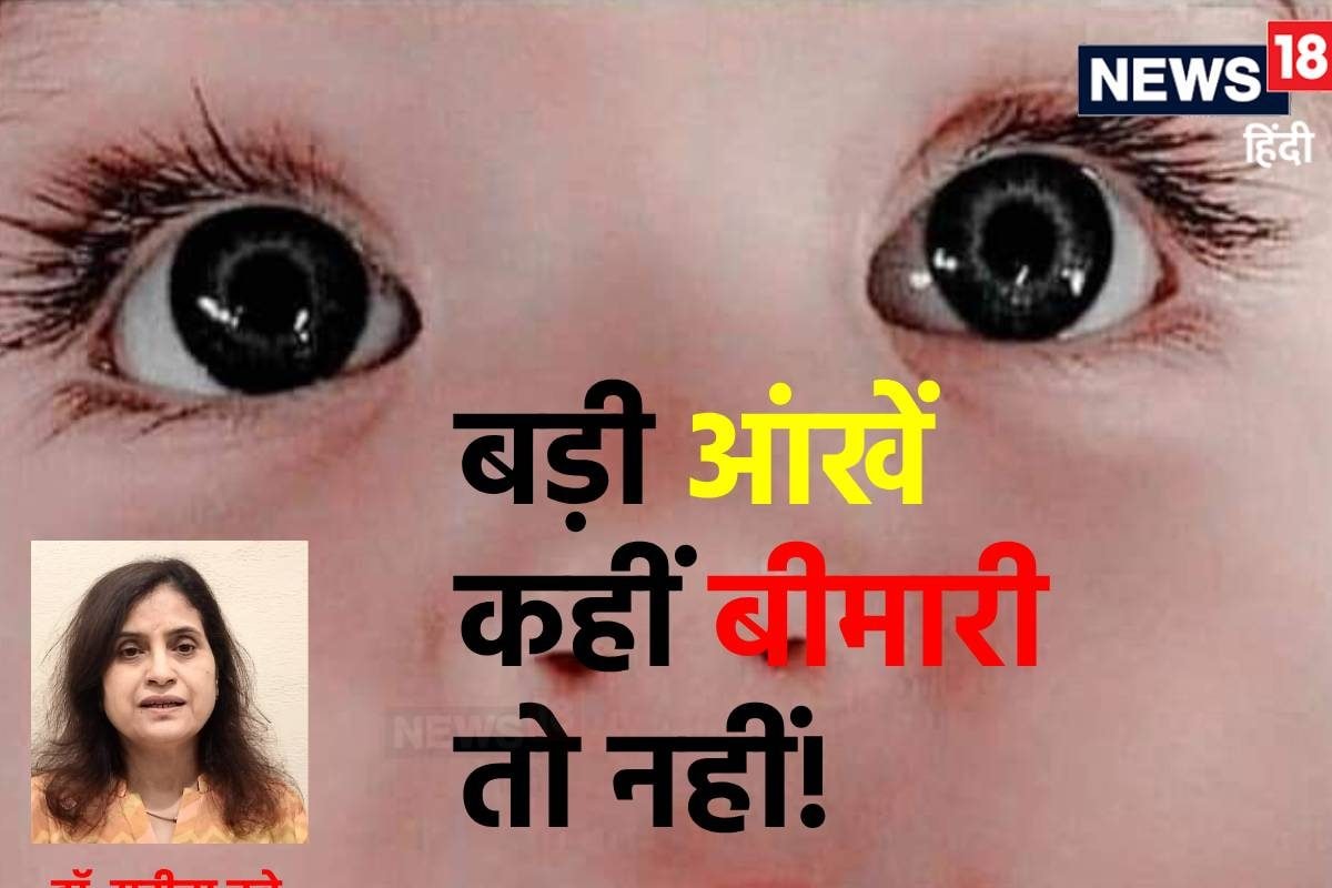 बच्चे की बड़ी-बड़ी आंखों पर खुश न होइए! अंधे होने की हो सकती है शुरुआत: डॉ. सुनीता दुबे