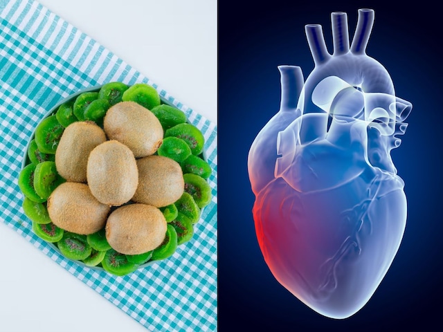 विटामिन्स का भंडार है आलू जैसा दिखने वाला ये फल,  मिलते हैं ये फायदे 