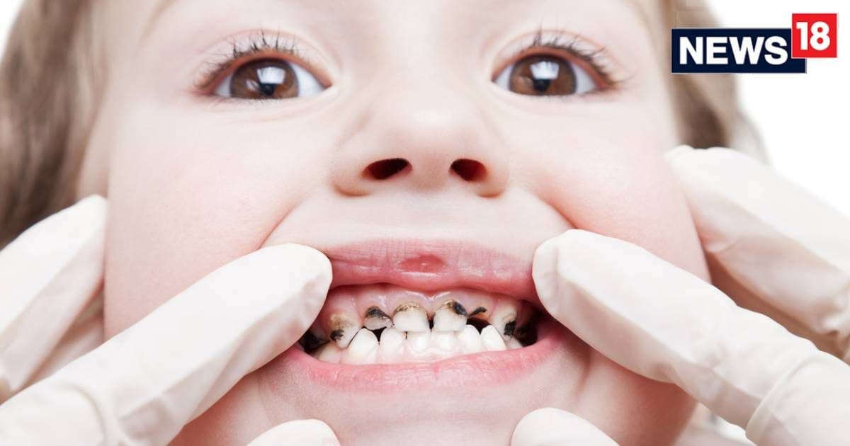 स्कूली बच्चों के दांतों में डॉक्टरों को दिख रहीं ऐसी चीजें, पेरेंट्स की टेंशन हो जाएगी….
